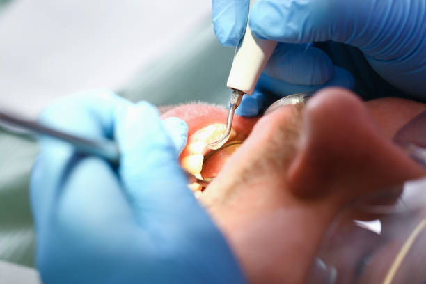 Best Pediatric Emergency Dentist in Burkburnett, TX