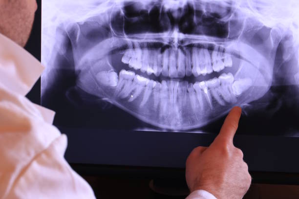 Best Emergency Dental Care for Broken or Chipped Teeth in Burkburnett, TX