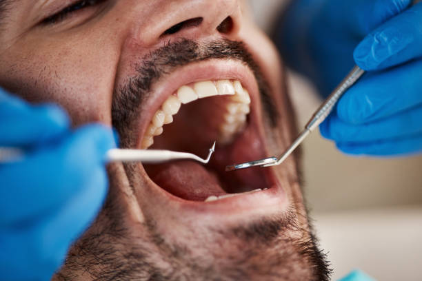 Best Emergency Dental Care for Broken or Chipped Teeth in Burkburnett, TX
